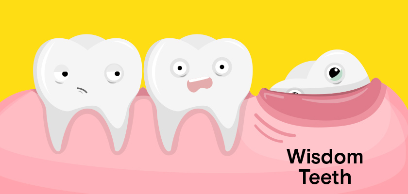 Cost of Removing Wisdom Teeth